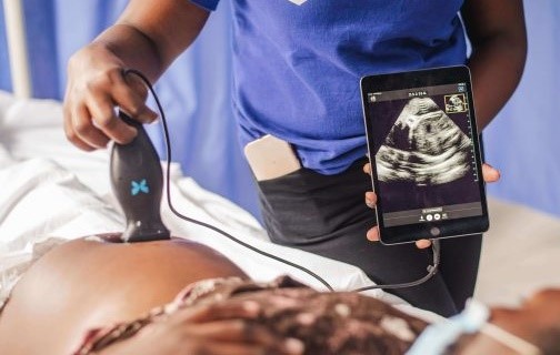 The Butterfly Ultrasound Probe in use