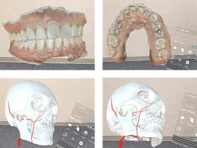 Holoeyes 3D images promotes rapid anatomical understanding in dentistry. 